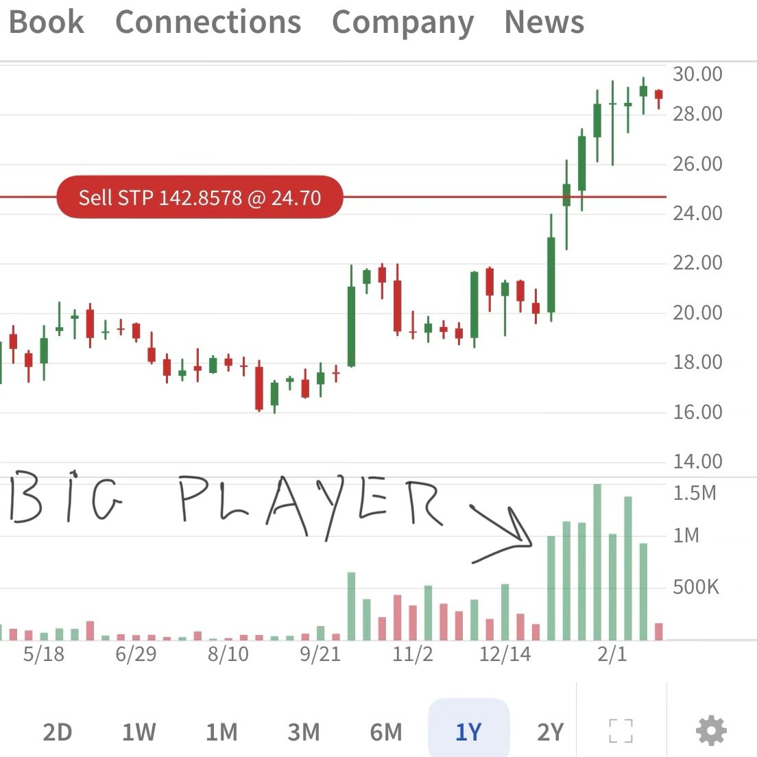 Oculis (OCS) Investment Strategy: Following Smart Money Moves